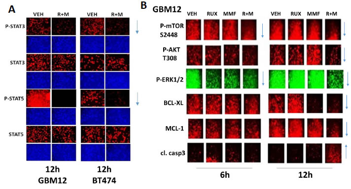 [MMF + Ruxolitinib] interact to cause a prolonged suppression of STAT3, STAT5, ERK1/2, AKT and mTOR phosphorylation.