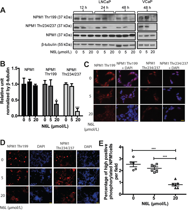 N6L reduced NPM1 phosphorylation on Thr199 and Thr234/237.