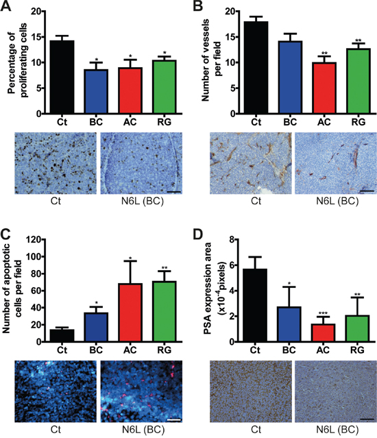 N6L inhibited cell proliferation, angiogenesis and PSA expression and induced apoptosis in vivo.