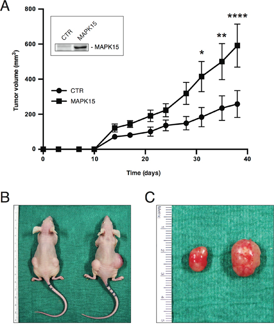 MAPK15 affects the tumorigenicity of human GCT-derived cell lines.