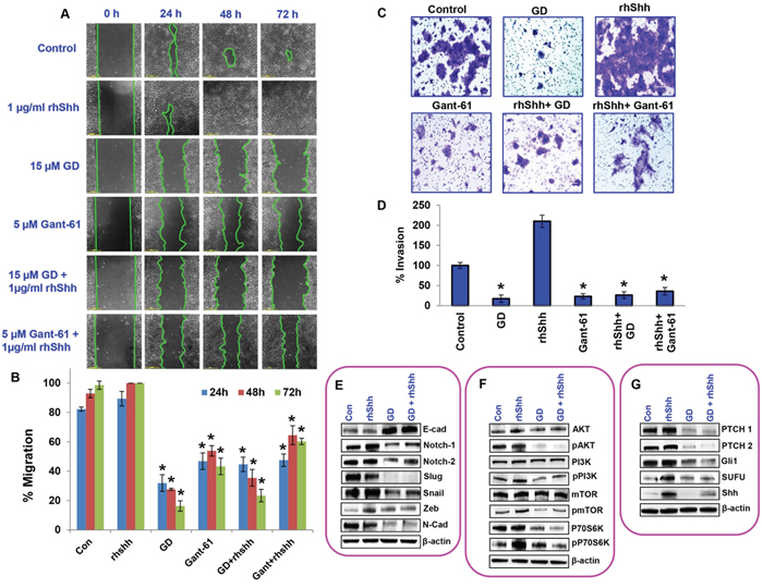 Gedunin inhibits growth and metastasis of pancreatic cancer cell through the sonic hedgehog/Gli signaling.