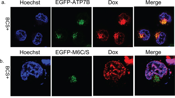 Subcellular localization of doxorubicin and EGFP-ATP7B or EGFP-M6C/S.