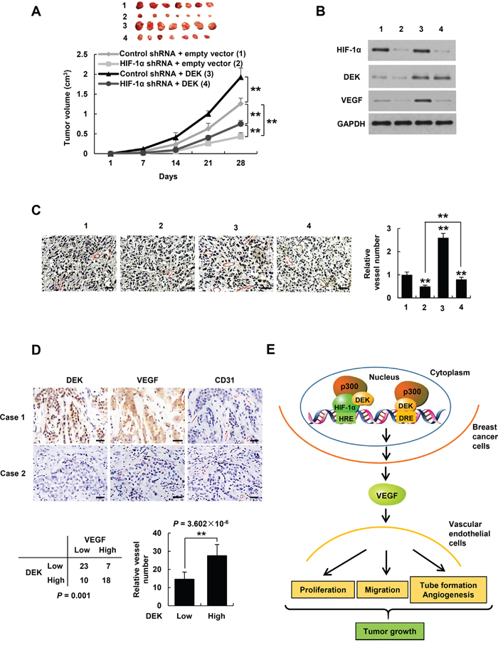 DEK controls tumor angiogenesis in HIF-1&#x03B1;-dependent and -independent manners.