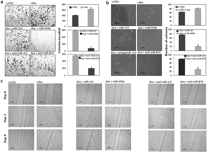 Functional effect of restoring miR-449a and miR-874 in CaP cells.