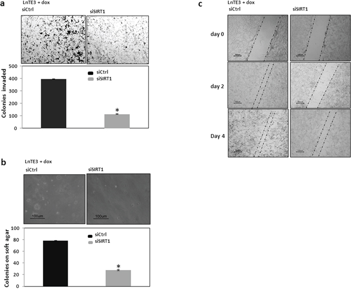 Functional analyses of SIRT1 in ERG-inducible LnTE3 cells.