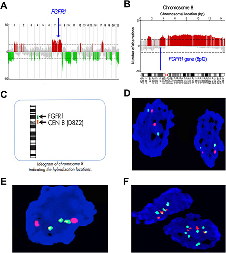 Profile of gene copy number alterations and FGFR1 gene amplification in MPNST.