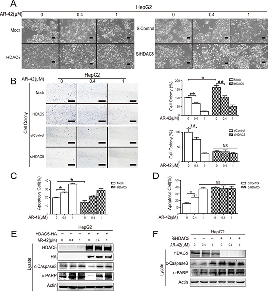 AR-42 induced HepG2 cell apoptosis in vitro.