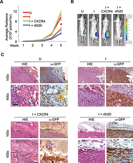 KLF8 activation of CXCR4/CXCL12 signaling is required for invasive growth of the orthotopic breast tumor.