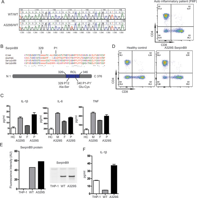 Effects of serpinB9 mutation in patients and THP-1 cell line.