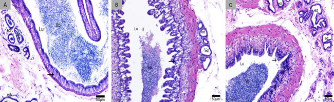 Sperm storage in the epididymis.