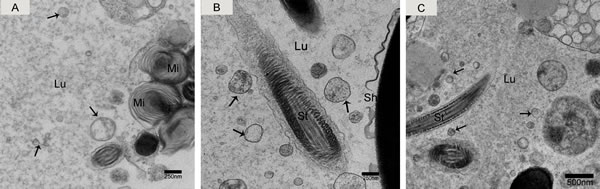 Electron micrograph of nano-scale exosomes (arrowhead) around spermatozoa in the epididymal lumen.