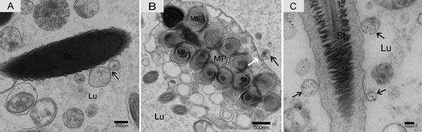 Electron micrograph of nano-scale exosomes and spermatozoa in the epididymis.