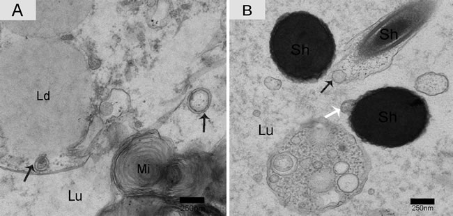 Electron micrograph of nano-scale exosomes with double-layer membranes and absorption in the epididymis.