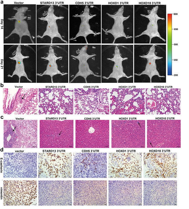 Effects of STARD13- and its ceRNAs-3&#x2032;UTRs on metastasis and EMT of breast cancer in a xenograft model.