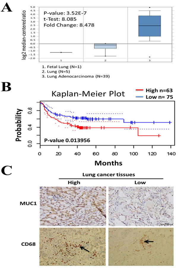 Clinical association of Muc-1 in lung cancer patients.