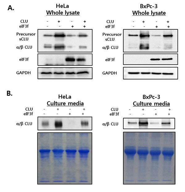 sCLU expression and secretion in whole cell lysates and culture media.
