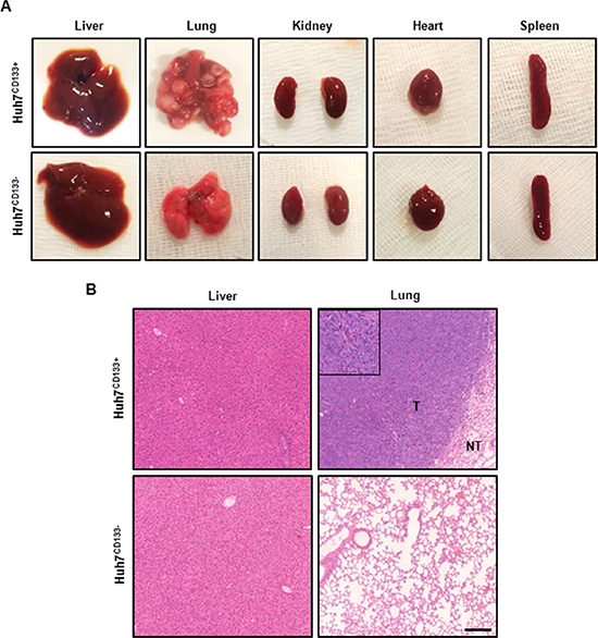 Gross photography of dissected organs and H &#x0026; E staining from representative tumor from metastasis in vivo model.