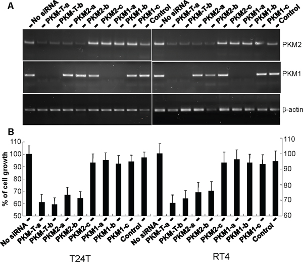 Inhibition of urothelial carcinoma cell proliferation via down-regulation of PKM2 but not PKM1.