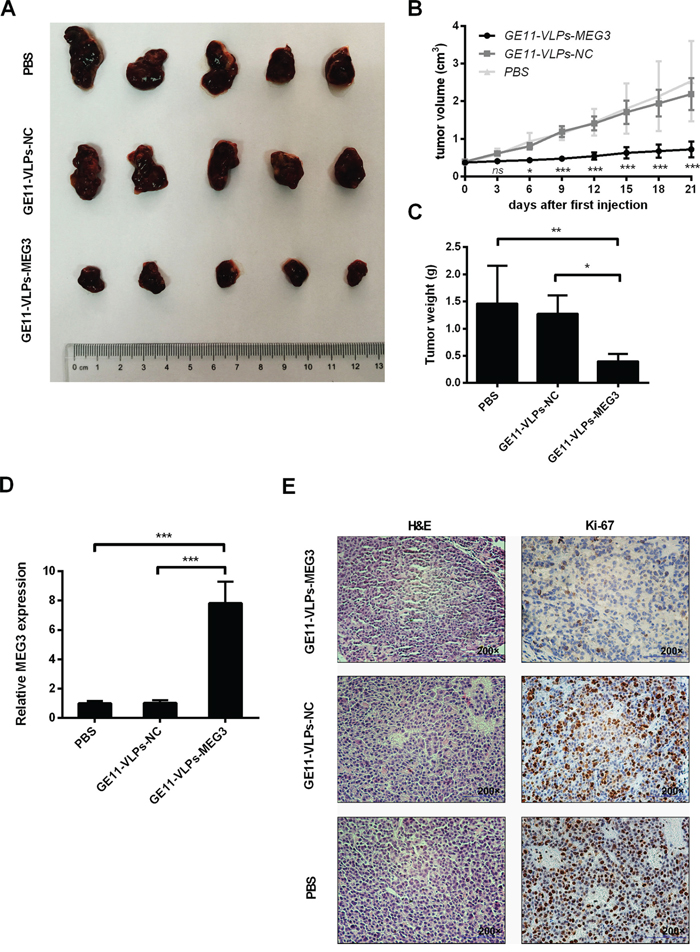Effects of MEG3 on tumor growth in vivo.