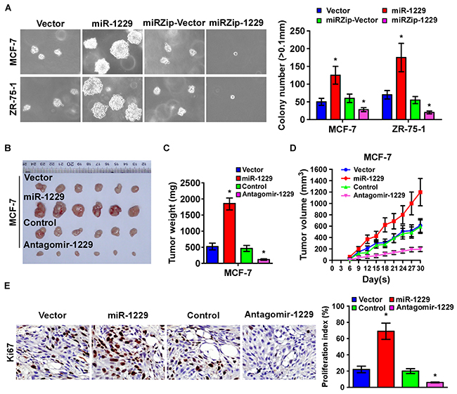 Silenced endogenous miR-1229 inhibits breast cancer tumorigenicity in vitro and tumor growth in vivo.