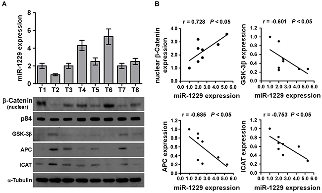 MiR-1229 levels correlate with activation of Wnt/&#x03B2;-catenin signaling, &#x03B2;-catenin nuclear accumulation, and GSK-3&#x03B2;, APC, and ICAT expression in clinical breast cancer clinical tissues.