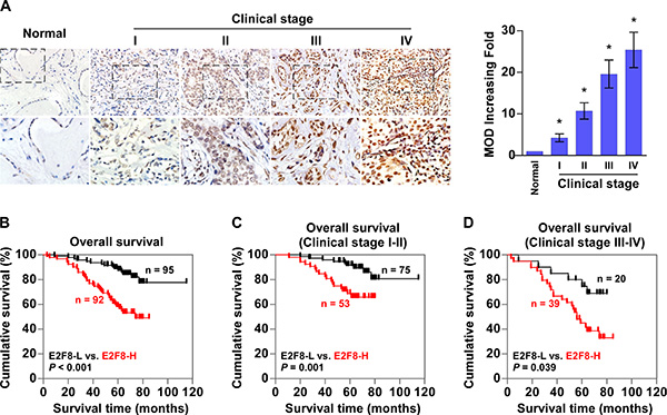 Upregulation of E2F8 correlates with progression and poor prognosis in breast cancer.