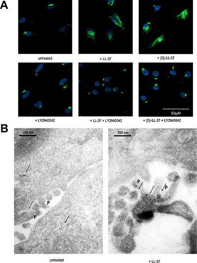 LL-37 induces PI3K-dependent TRPV2 translocation to pseudopodia membranes.