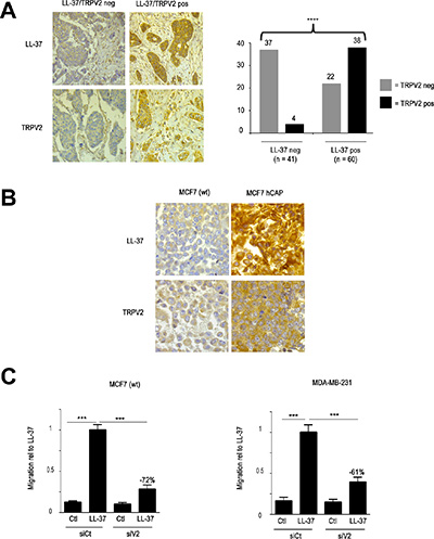 LL-37 and TRPV2 cooperate in cell cancer lines and breast tumors.