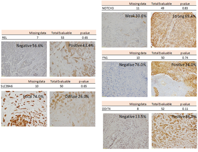 Representative Inmunohistochemistry for REL, SLC39A6, NOTCH3, FN1 and DDIT4.