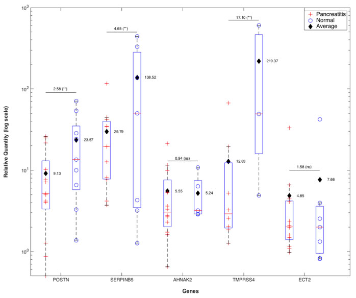 qRT-PCR validation of 5-gene PDAC classifier on retrospective microdissected FFPE samples from patients with PDAC.