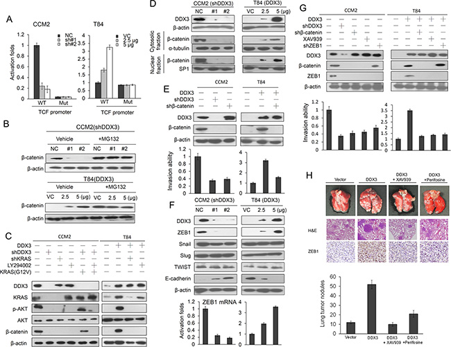 DDX3-mediated &#x03B2;-catenin activation is responsible for cell invasion via increasing ZEB1 expression.