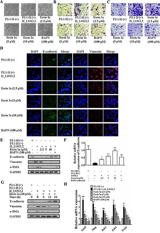 Effect of escin Ia on epithelial-mesenchymal transition in LOXL2-transfected MCF-7 cells.