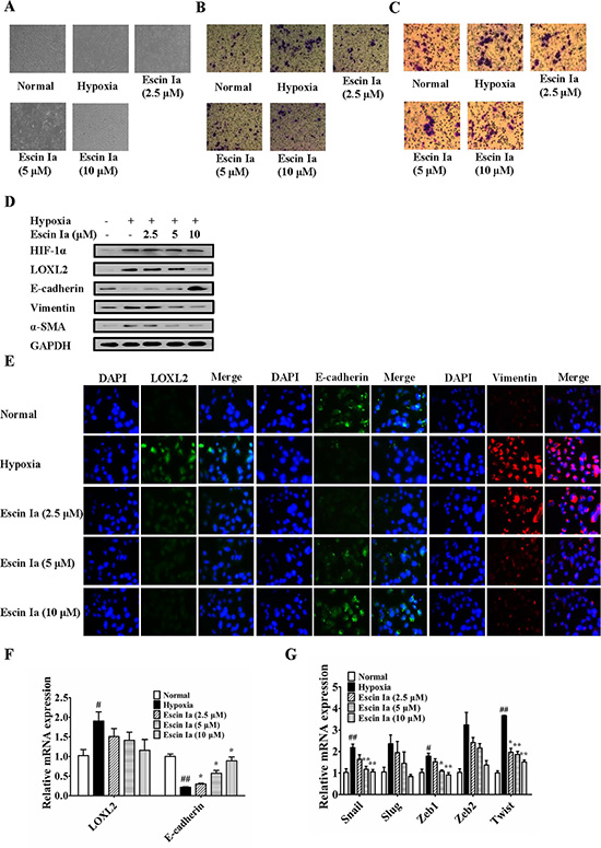 Effect of escin Ia on epithelial-mesenchymal transition in hypoxia-stimulated MCF-7 cells.