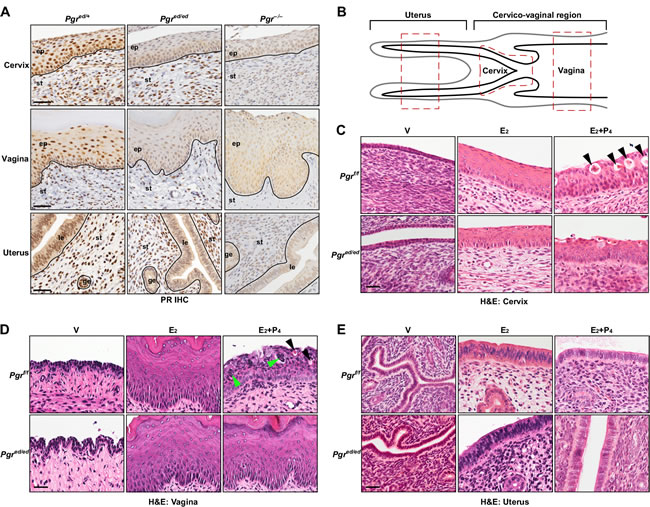 Histology of female reproductive tracts in epithelial PR&#x2212;deficient mice treated with E
