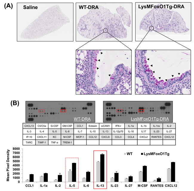 LysMFoxO1Tg mice showed impaired development of DRA-induced allergy airway inflammation.