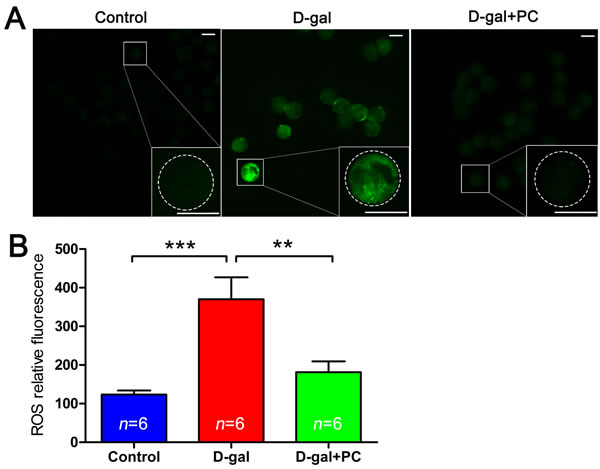 PC inhibited ROS level in MII oocytes in D-gal-induced aging mice.