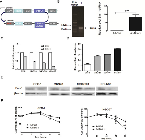 Construction of Ad-Bmi-1i vector (Bmi-1i) and its Bmi-1 interference efficacy for GC cells with different Bmi-1 expression levels in vitro.