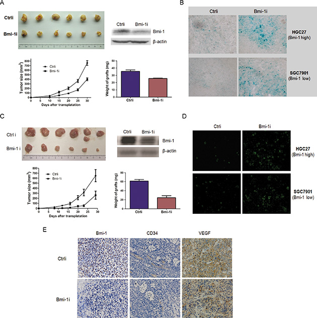 Ad-Bmi-1i suppresses tumor growth in GC xenografts in vivo.