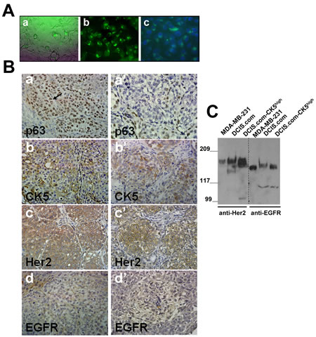 Her2/neu is overexpressed in MCF10DCIS.com subpopulations selected for CK5 overexpression.