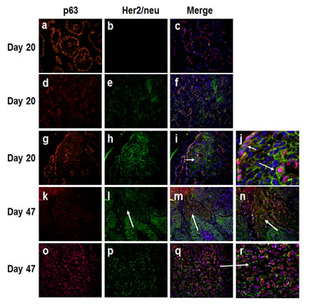 Immunofluorescence analysis of p63 and Her2/neu in MCF10DCIS.com xenografts.