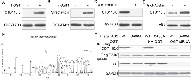 TAB3 is O-GlcNAcylated on Ser408 in TNBC cells.