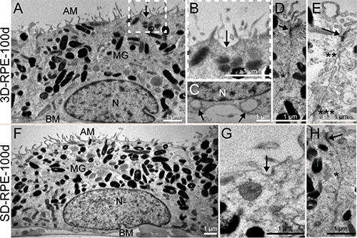 The ultrastructure of 3D-RPE and SD-RPE cells.