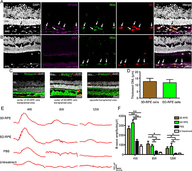 3D-RPE cells rescued retinal degeneration when grafted into the subretinal space of RCS rats.
