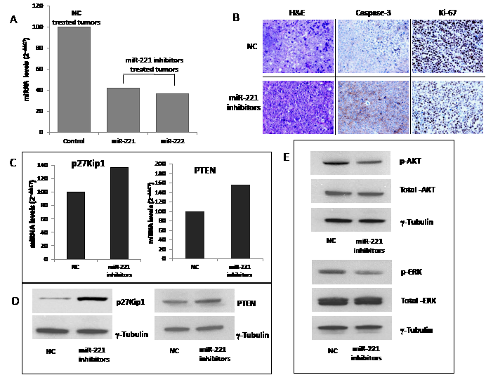 miR-221 activity and targets silencing in retrieved MM xenografted tumors.