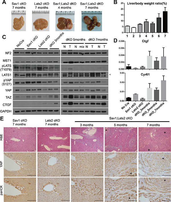 Ablation of negative feedback on YAP accelerates the YAP activity-induced mouse liver phenotype.