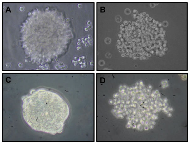Morphological differences between cervospheres enriched with cancer stem cells derived from human cervical cancer cell lines.