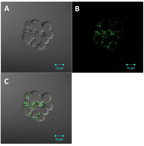 Annexin II HPV co-receptor is expressed on the cell surface of cervosphere cells.