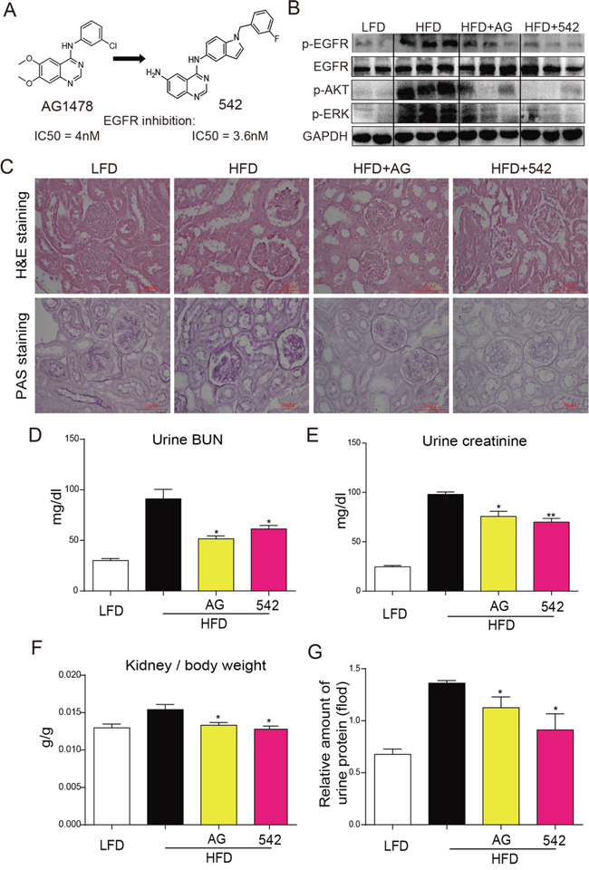 Oral administration of EGFR inhibitors suppressed HFD-induced EGFR signaling and attenuated kidney injury in ApoE-/- mice.