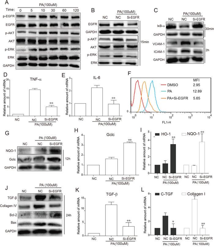 EGFR silencing inhibited PA-induced activation of EGFR signaling, inflammation, oxidation and fibrosis in NRK-52E cells.