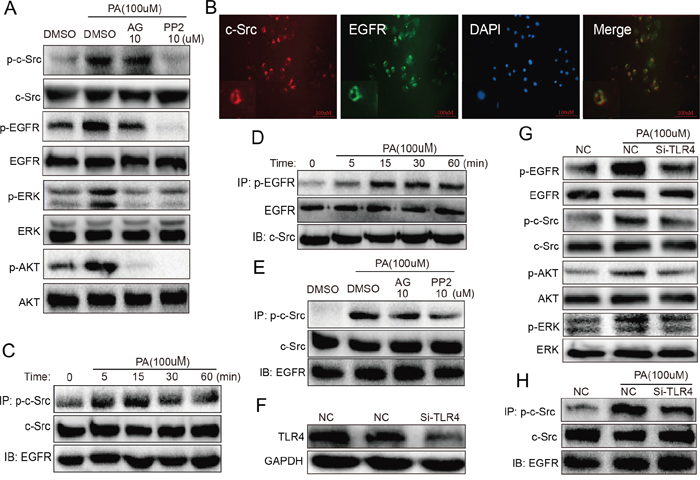 TLR4 regulated PA-induced phosphorylation of EGFR and c-Src in the EGFR/c-Src complex in NRK-52E cells (TLR4 silencing inhibits PA-induced phosphorylation of c-Src in the EGFR/c-Src complex and EGFR signaling in NRK-52E cells).